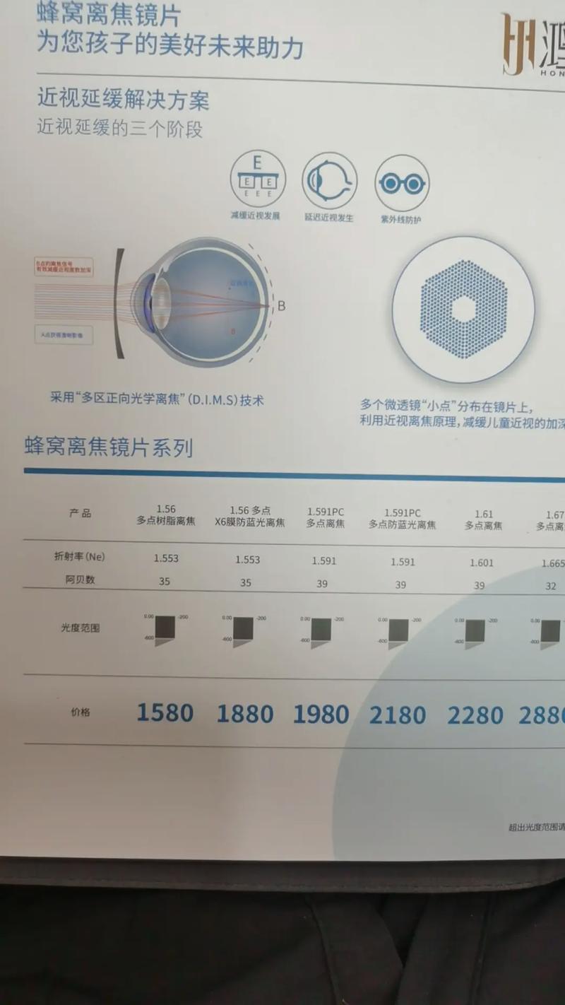 開啟近視防控新視野 神秘“蜂窩眼鏡”的工作原理與功效揭秘
